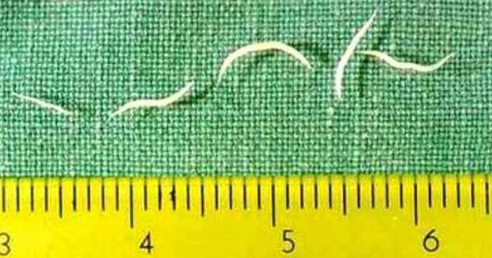 Pinworms жас балалардағы құрттардың ең көп таралған түрі болып табылады. 