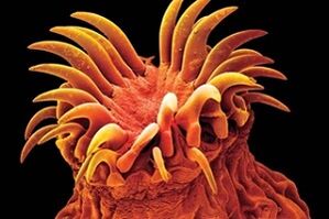 Трематодтар паразиттер