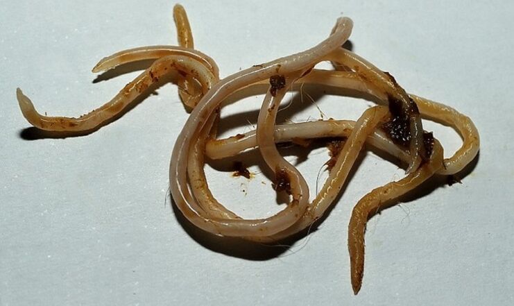 Toxocara адам денесінен