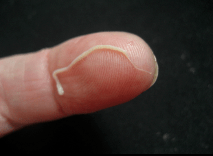 Адам ағзасынан дөңгелек құрт